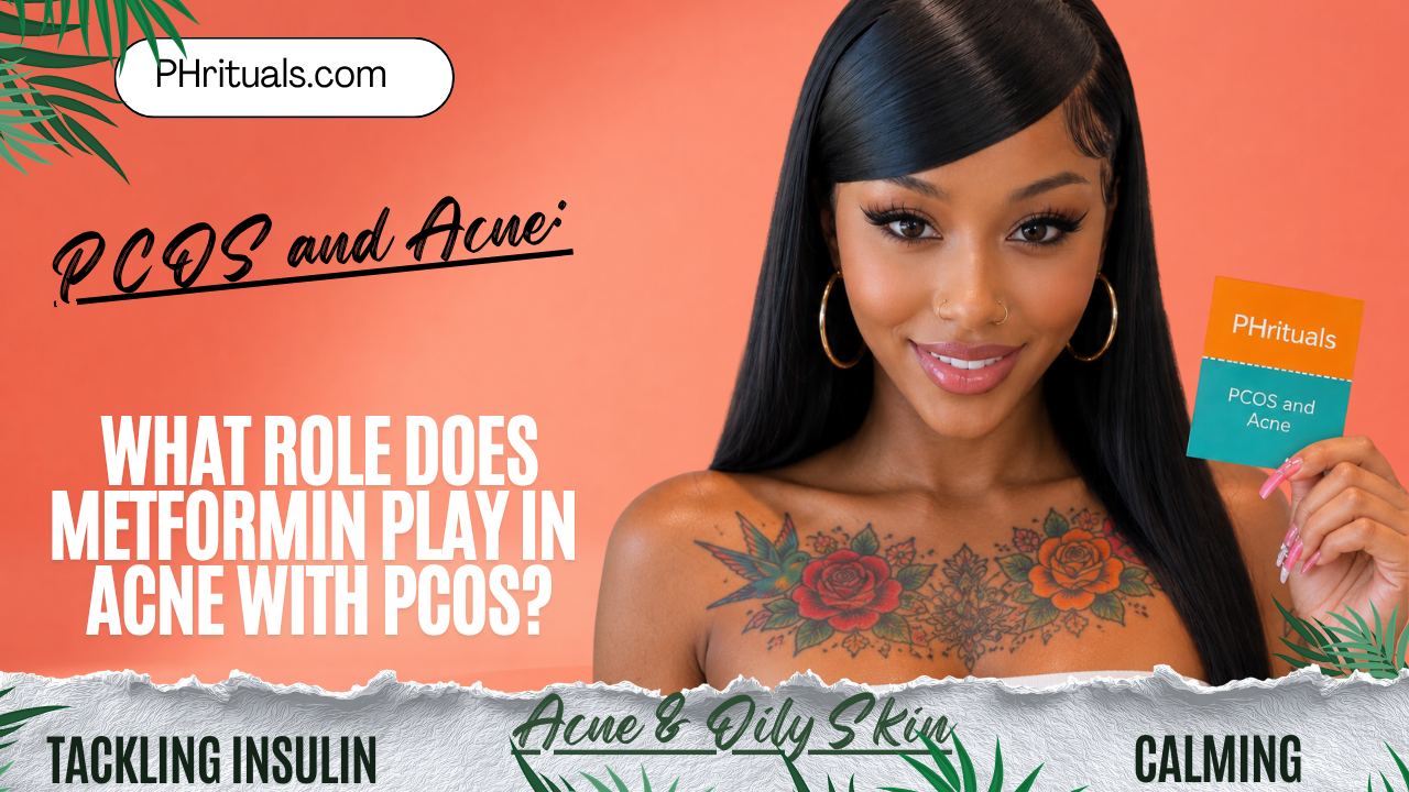 What role does metformin play in acne with PCOS