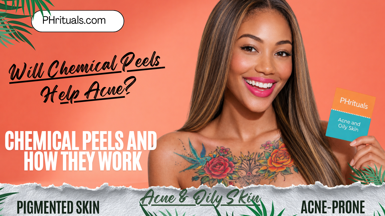 Will chemical peels help acne