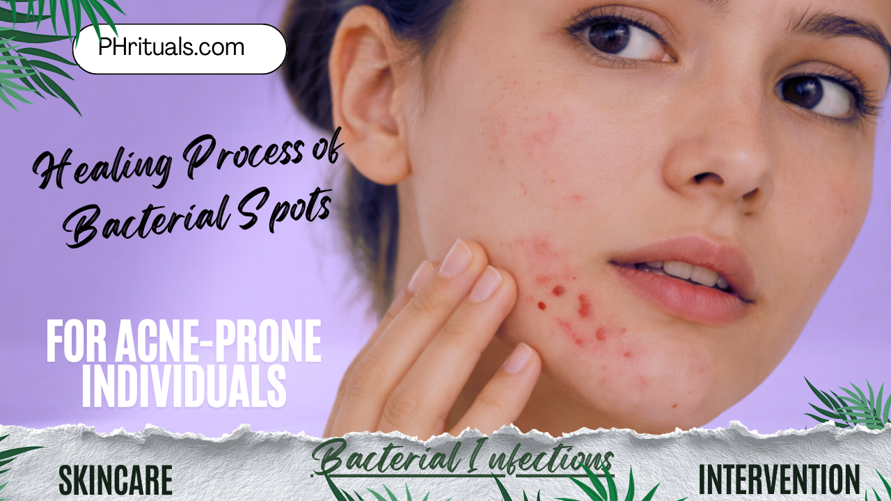 How Long Until a Bacterial Spot Clears