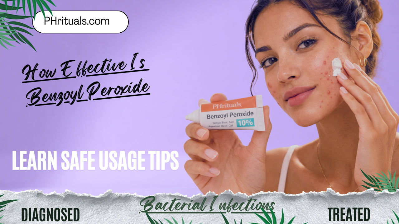 How effective is benzoyl peroxide for acne